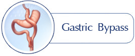 Gastric Bypass - Martin Obesity Surgery
